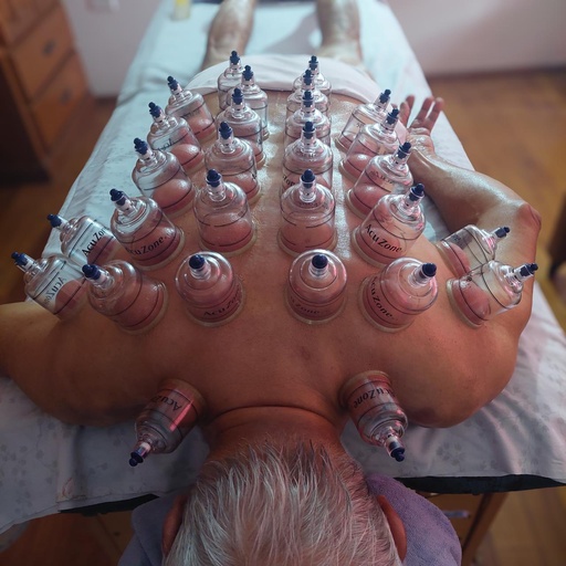 Upper Body Cupping