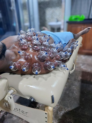 Full Body Cupping